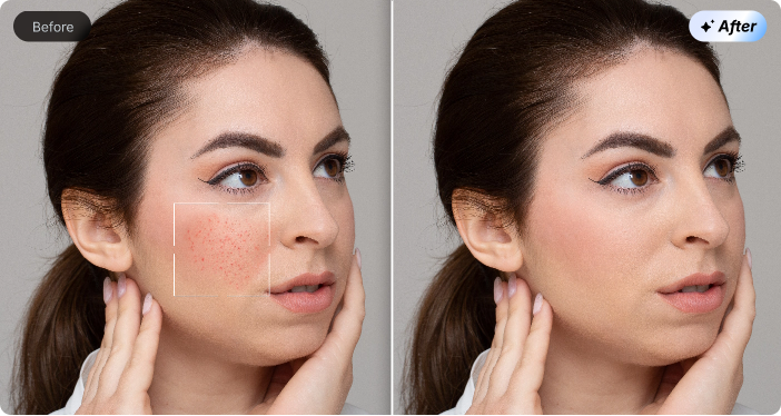 AI Skin Smooth