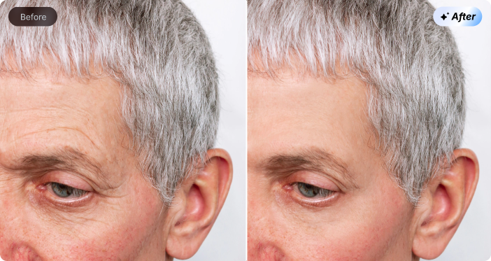 Remove Wrinkle from Photo
