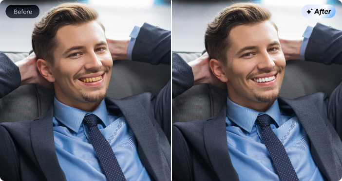 AI Teeth Whiten